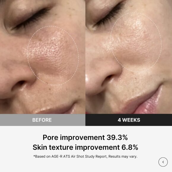 Medicube Air Shot Device - Picture 6 of 6